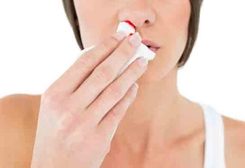 Burun Kanaması Tampon Nasıl Yapılır?